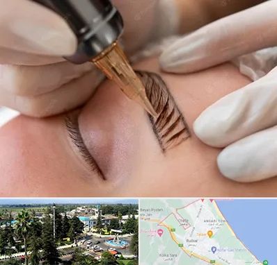 میکروبلیدینگ در رودسر