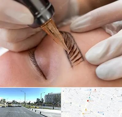 میکروبلیدینگ در بلوار کلاهدوز مشهد