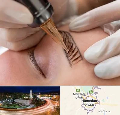 میکروبلیدینگ در همدان