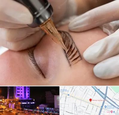 میکروبلیدینگ در آبرسان تبریز