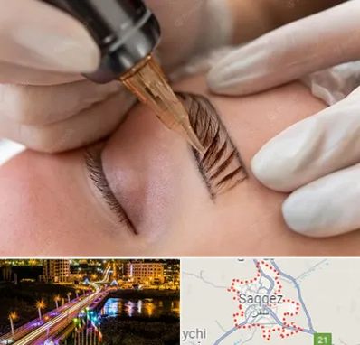 میکروبلیدینگ در سقز