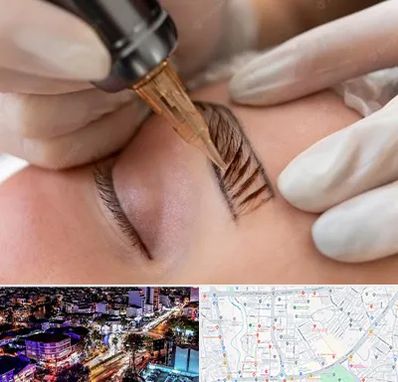 میکروبلیدینگ در منظریه رشت