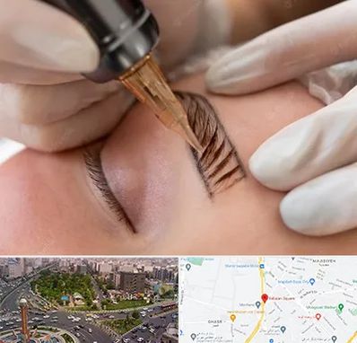 میکروبلیدینگ در سبلان