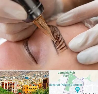 میکروبلیدینگ در نیاوران