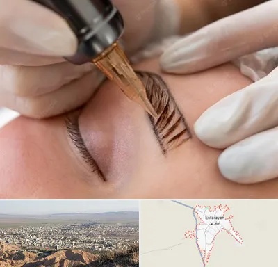 میکروبلیدینگ در اسفراین
