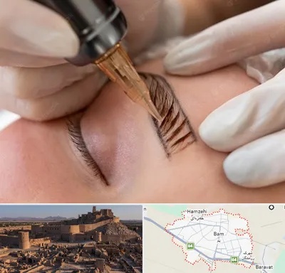 میکروبلیدینگ در بم
