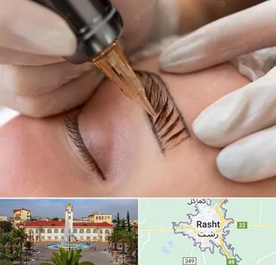 میکروبلیدینگ در رشت