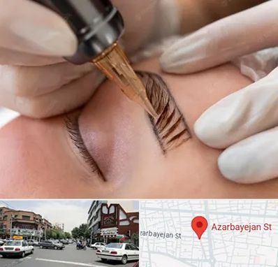 میکروبلیدینگ در خیابان آذربایجان