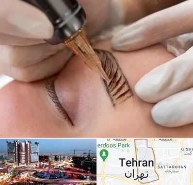 میکروبلیدینگ در صادقیه تهران