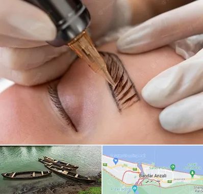 میکروبلیدینگ در بندر انزلی