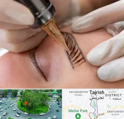 میکروبلیدینگ در تجریش