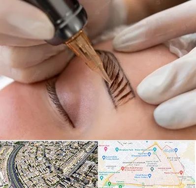 میکروبلیدینگ در شهرک غرب مشهد