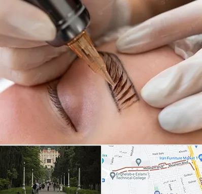 میکروبلیدینگ در بلوار معلم رشت