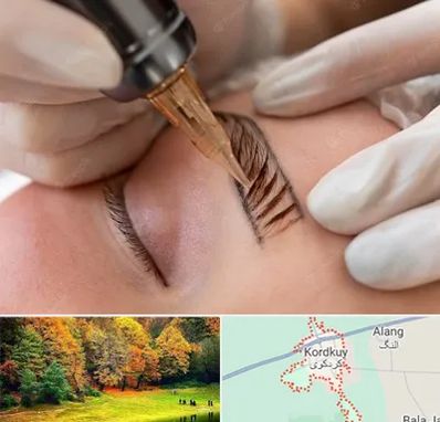 میکروبلیدینگ در کردکوی