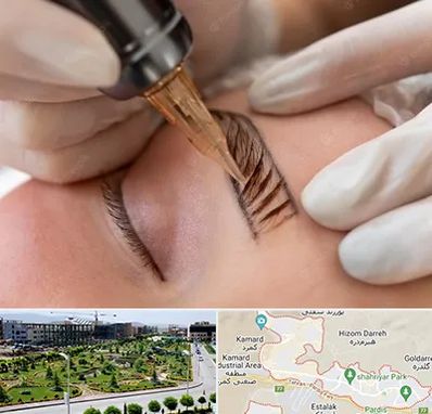 میکروبلیدینگ در پردیس