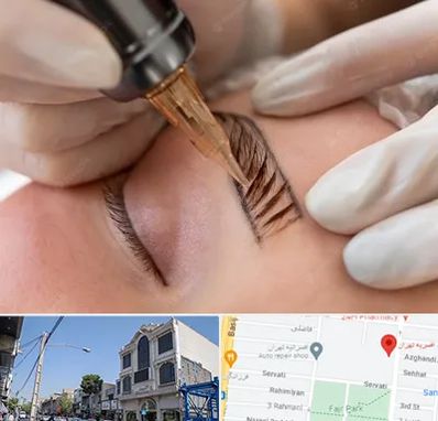 میکروبلیدینگ در افسریه