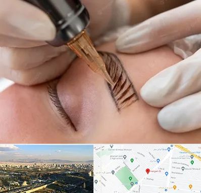 میکروبلیدینگ در هنگام