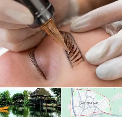 میکروبلیدینگ در صومعه سرا