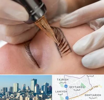 میکروبلیدینگ در قیطریه