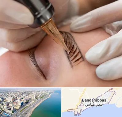 میکروبلیدینگ در بندرعباس