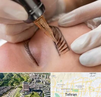 میکروبلیدینگ در شمال تهران