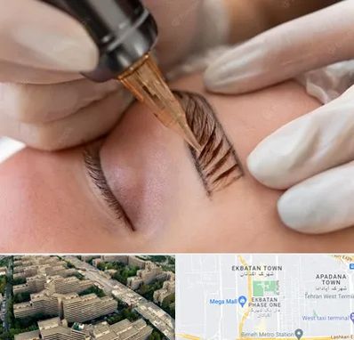 میکروبلیدینگ در اکباتان