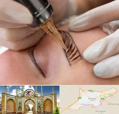 میکروبلیدینگ در سمنان