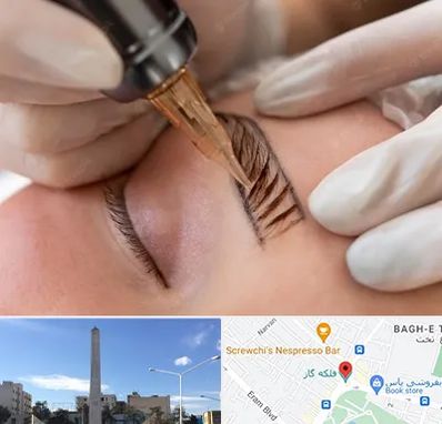 میکروبلیدینگ در فلکه گاز شیراز