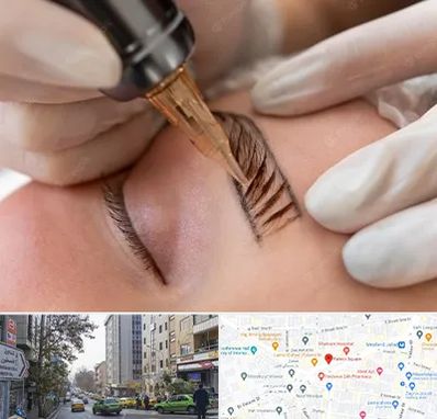 میکروبلیدینگ در فاطمی