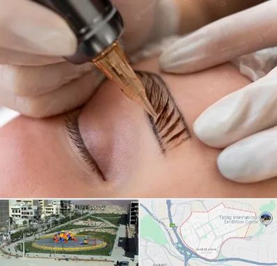 میکروبلیدینگ در مرزداران تبریز