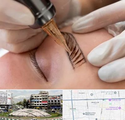 میکروبلیدینگ در مرکز تهران