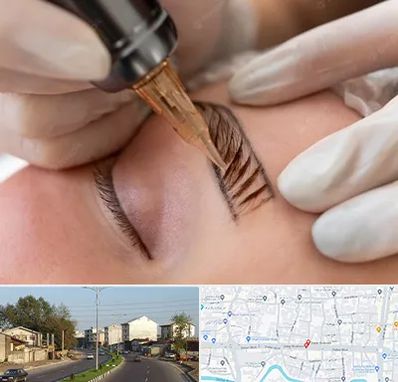 میکروبلیدینگ در ضیابری رشت