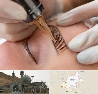 میکروبلیدینگ در شهرضا