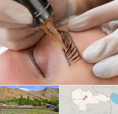 میکروبلیدینگ در خاش