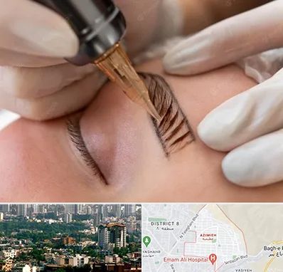 میکروبلیدینگ در عظیمیه کرج