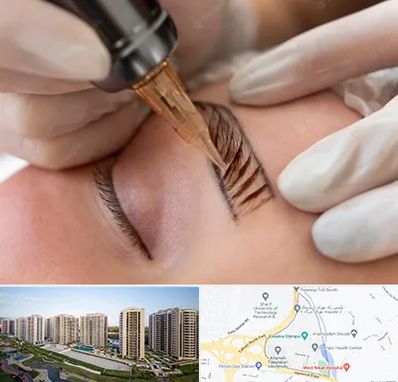 میکروبلیدینگ در المپیک