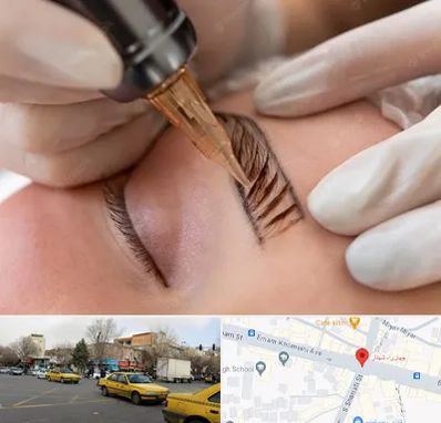 میکروبلیدینگ در شهناز تبریز