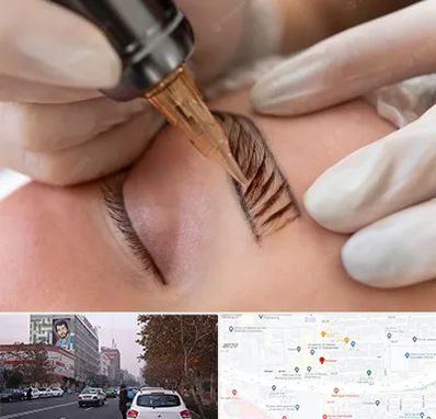 میکروبلیدینگ در کارگر شمالی