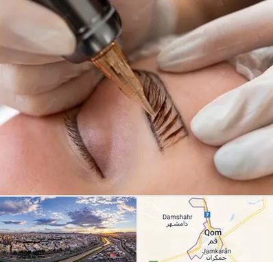 میکروبلیدینگ در قم