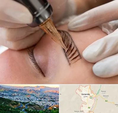 میکروبلیدینگ در سنندج