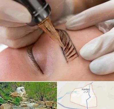 میکروبلیدینگ در کردان