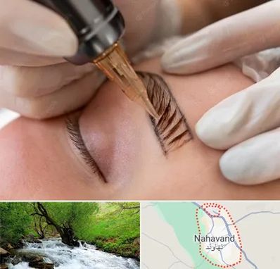 میکروبلیدینگ در نهاوند