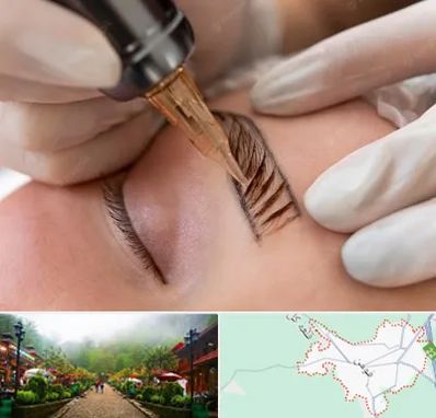 میکروبلیدینگ در فومن