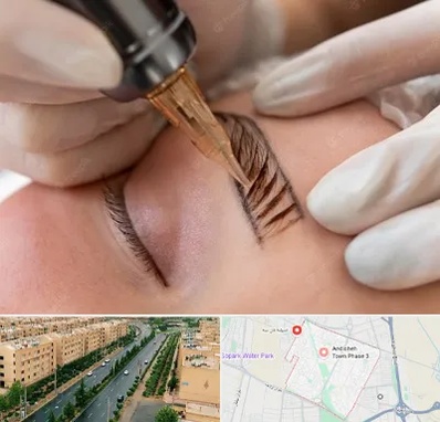 میکروبلیدینگ در فاز سه اندیشه