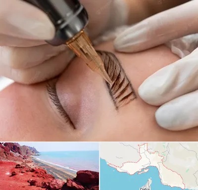 میکروبلیدینگ در هرمزگان