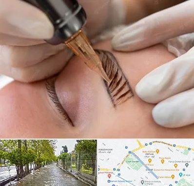 میکروبلیدینگ در خیابان ارم شیراز