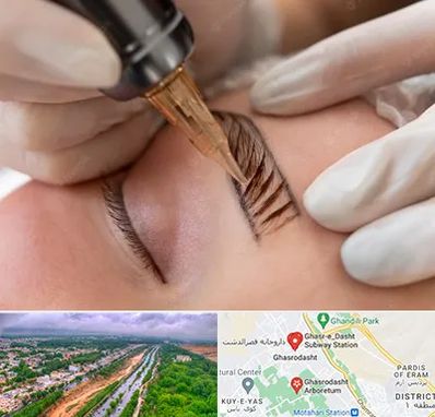 میکروبلیدینگ در قصرالدشت شیراز