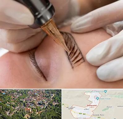 میکروبلیدینگ در دماوند