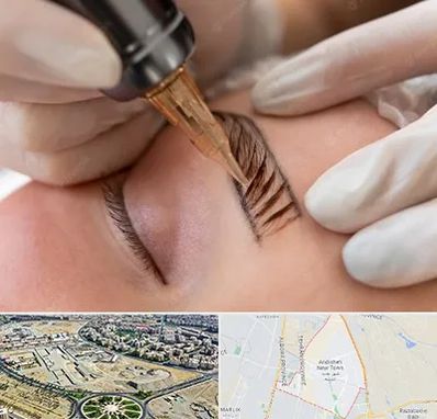 میکروبلیدینگ در اندیشه