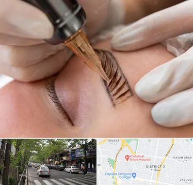 میکروبلیدینگ در ظفر